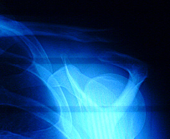 xray.jpg