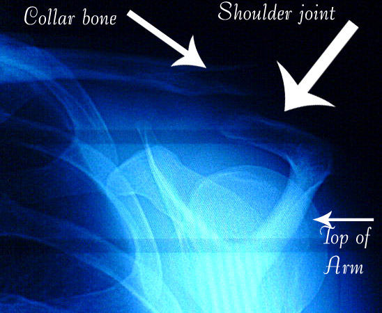 xraylabeled.jpg