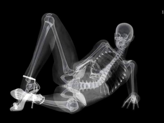 387877-skeleton-calendar.jpg