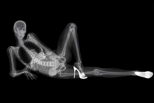 387888-skeleton-calendar.jpg