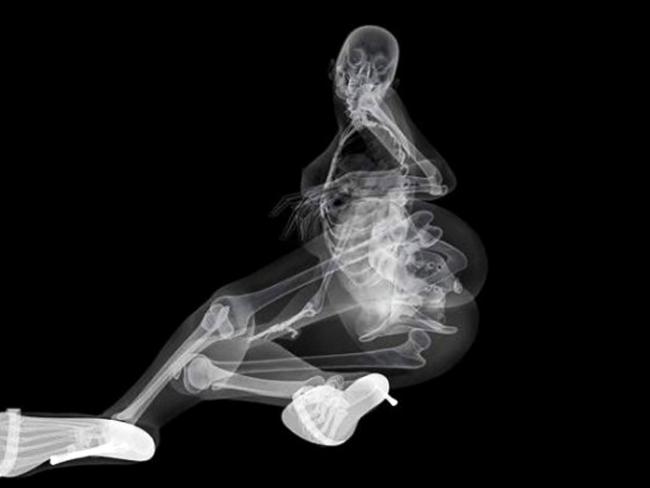 387925-skeleton-calendar.jpg