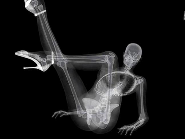 388082-skeleton-calendar.jpg