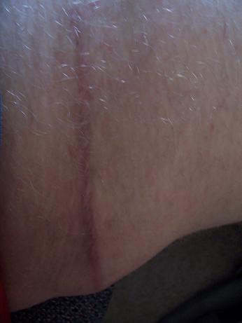 Inside leg.JPG