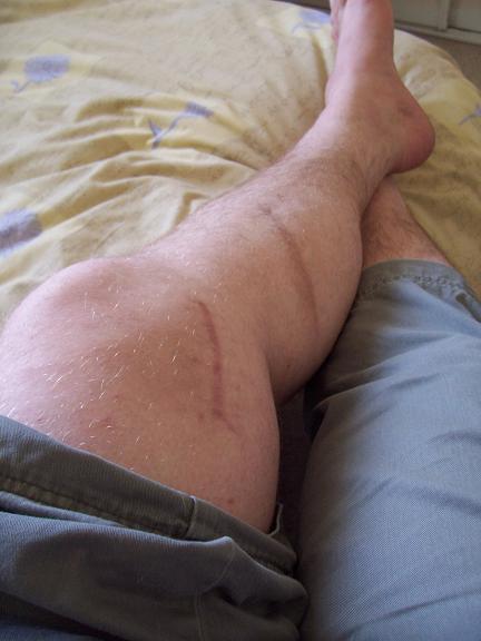 Knee & calf.JPG