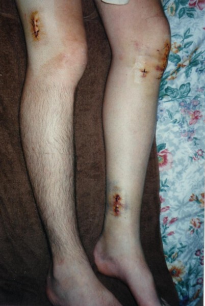 Ouch