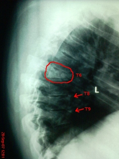 backxray-forum.jpg
