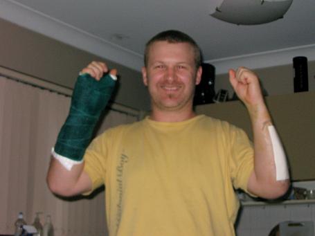 A battered and bruised dickhead who should have known better. Who also doesn't own a kawasaki anymore but does have a green cast.