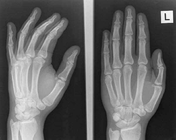 left hand.jpg