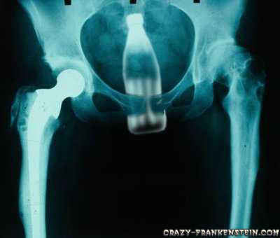 Gaz X-ray