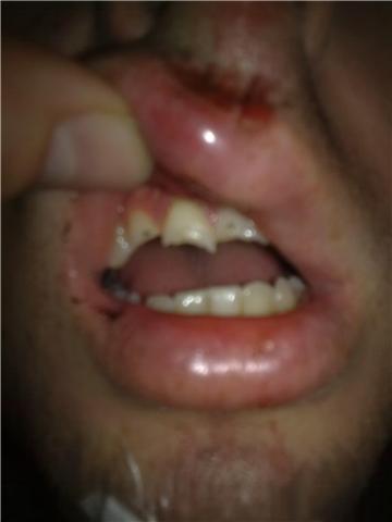 teeth.jpg
