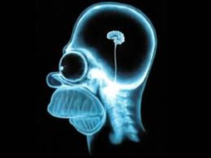homer mri (Medium).jpeg